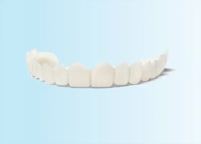 A custom Snap-On Smile removable cosmetic appliance