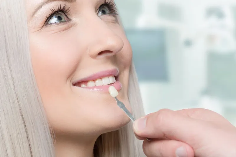 A dentist holding a porcelain veneer shade tab against a patient's smile to match the colour
