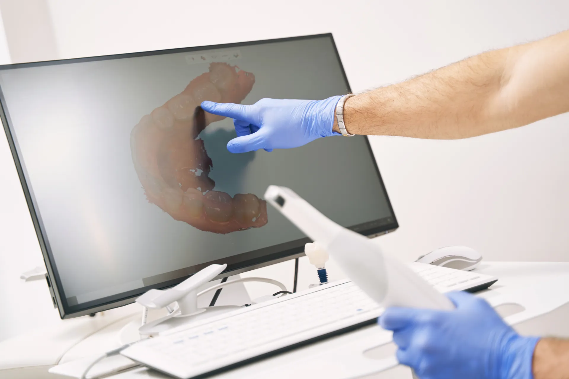 Digital scanning equipment used to plan implant treatment