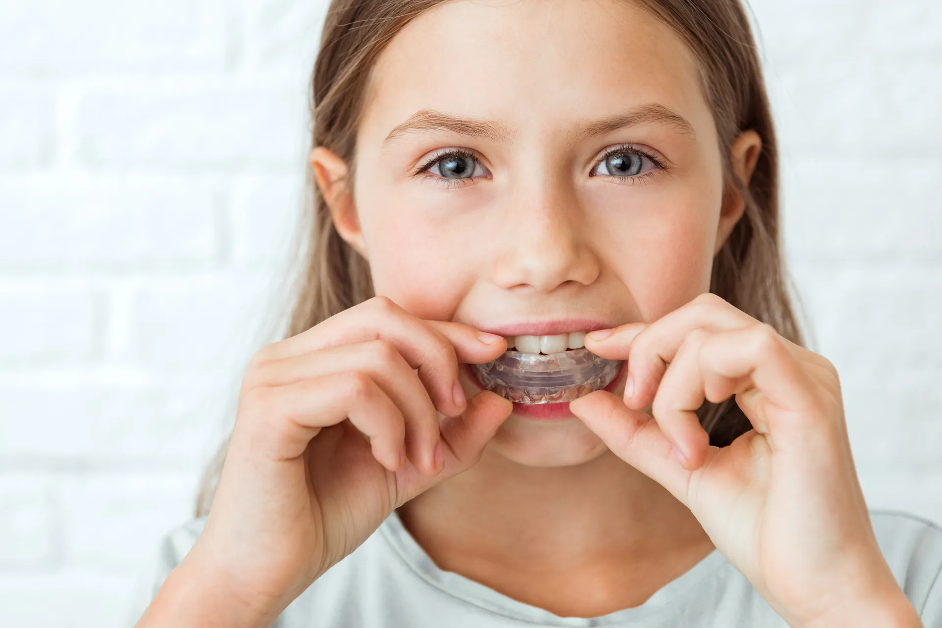 A young girl wearing a clear dental appliance