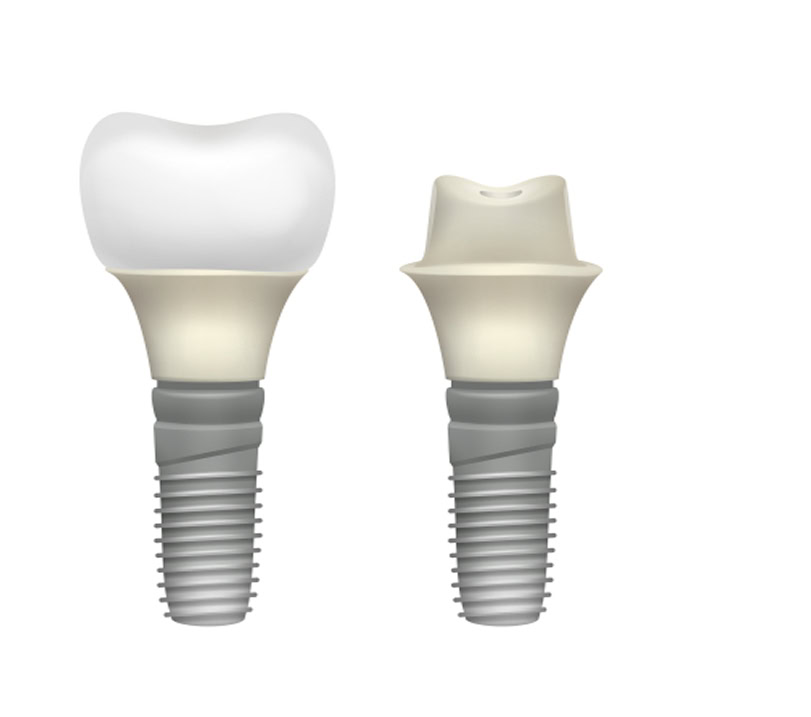 magical smiles point cook service detail s2 right img.jpg