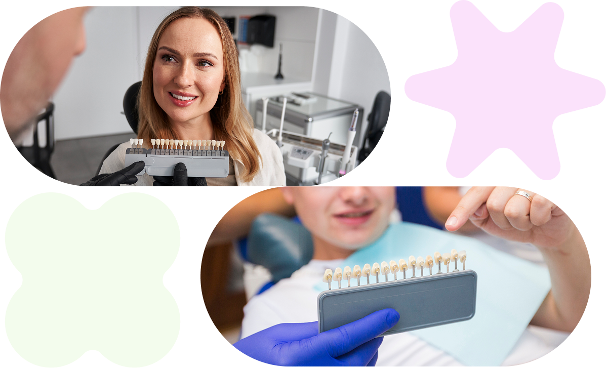 dental veneers services