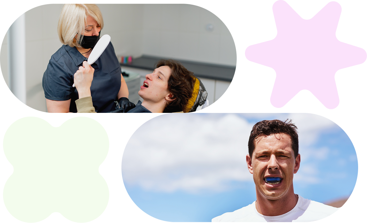 mouthguards services