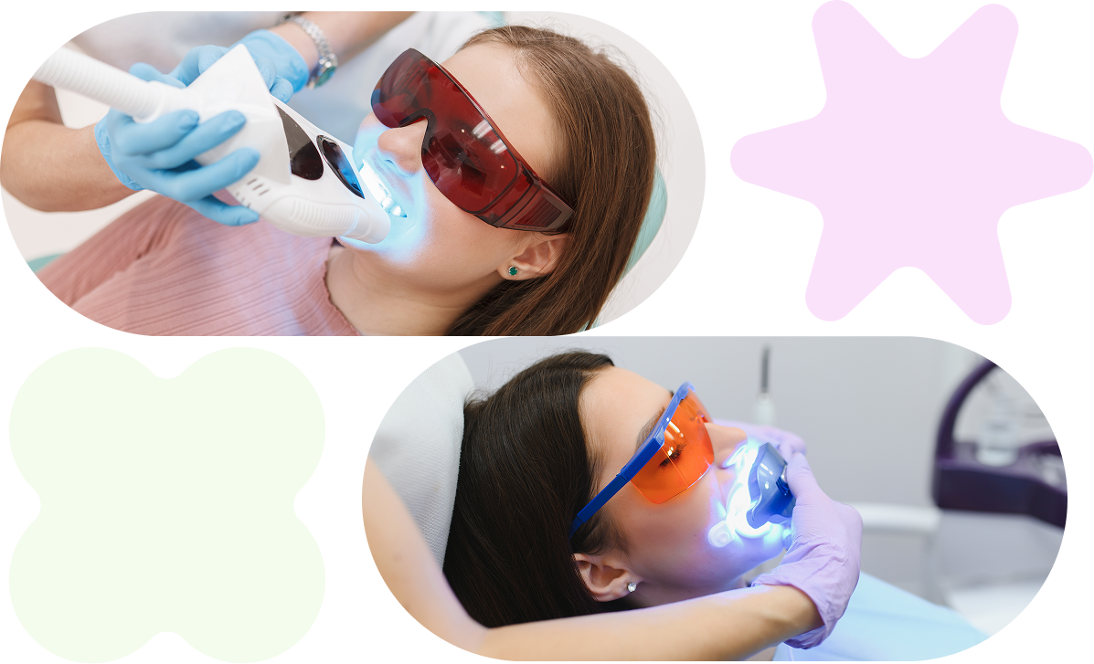 teeth whitening services