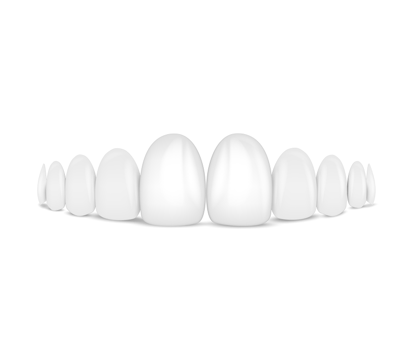 top cta porcelain veneers 1