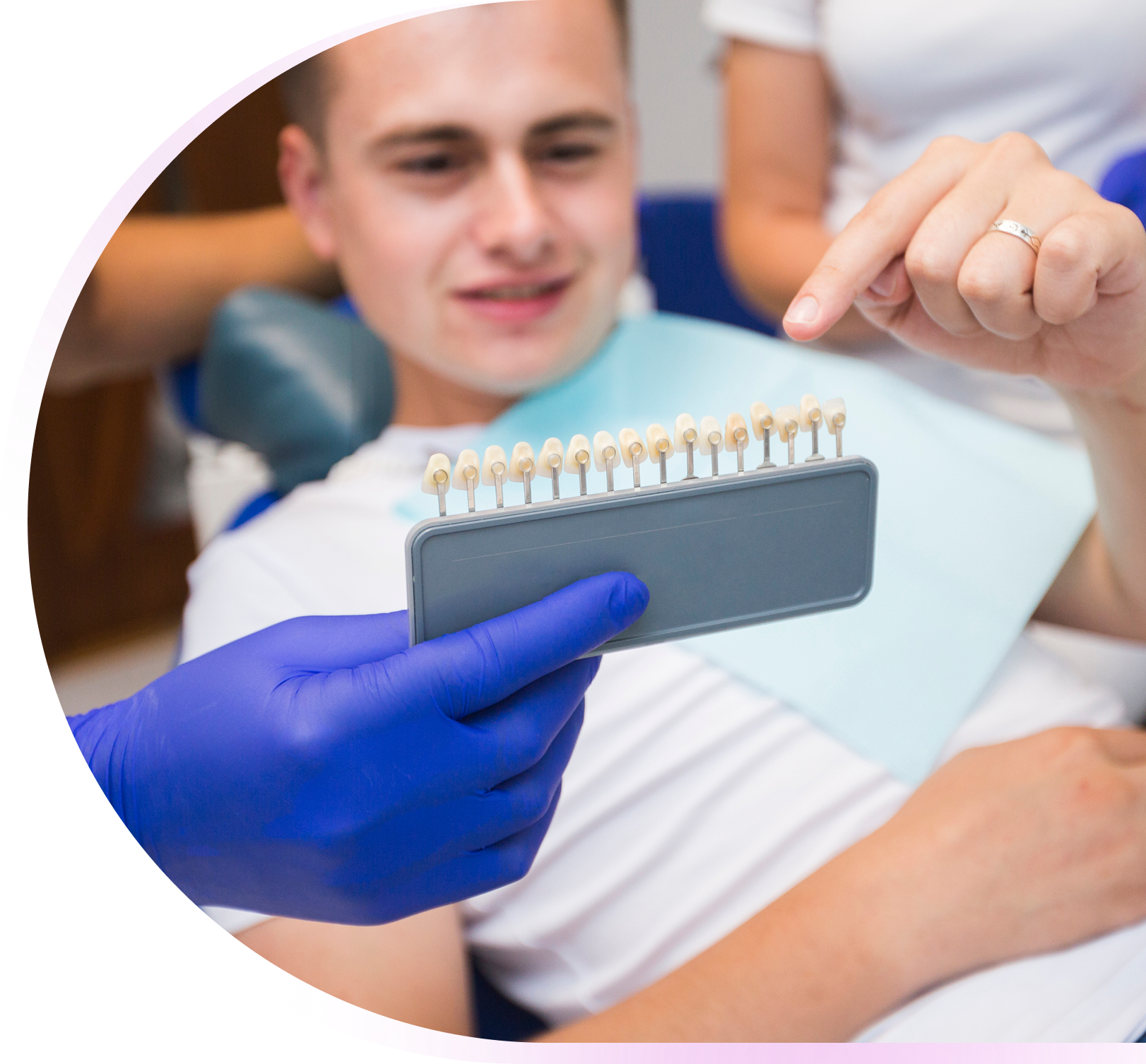 top porcelain veneers