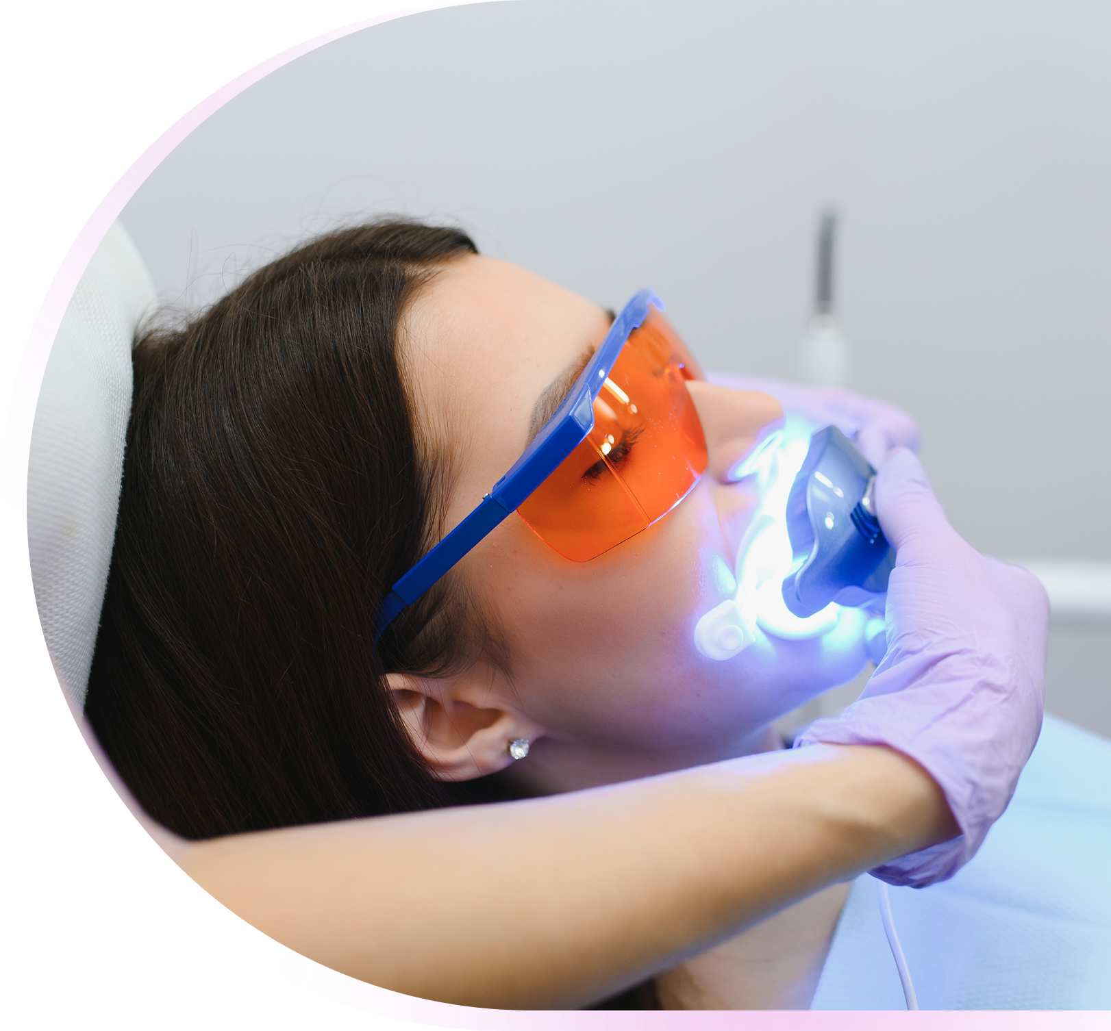 top teeth whitening