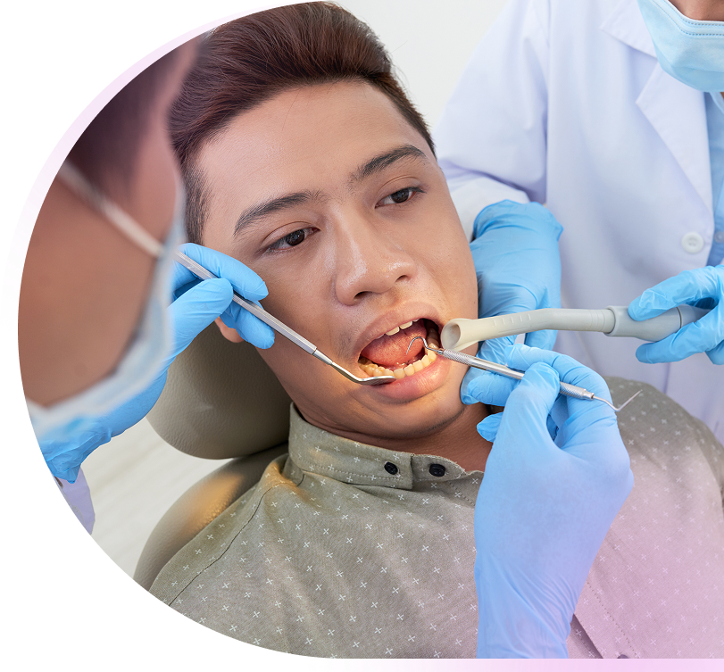 top wisdom tooth extraction